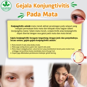 Gejala mata merah