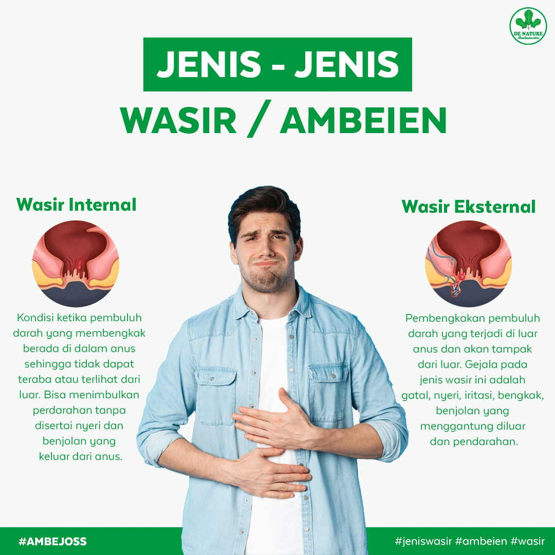 AMBEJOSS TIPS 1 PAKET OBAT WASIR