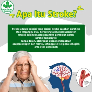 Apa itu stroke