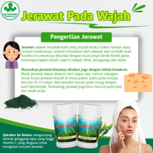 apa itu Jerawat