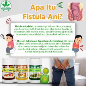 PAKET OBAT FISTULA ANI 1 apa itu fistula ani
