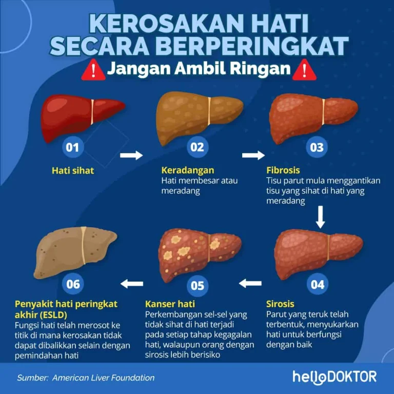 Gejala Penyakit Hati: Tanda-Tanda Awal dan Pengobatan 2 Pengobatan Gejala Penyakit Hati