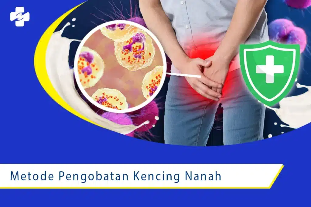 Penyebab dan Gejala Penyakit Kencing Nanah 2 Pengobatan Penyakit Kencing Nanah