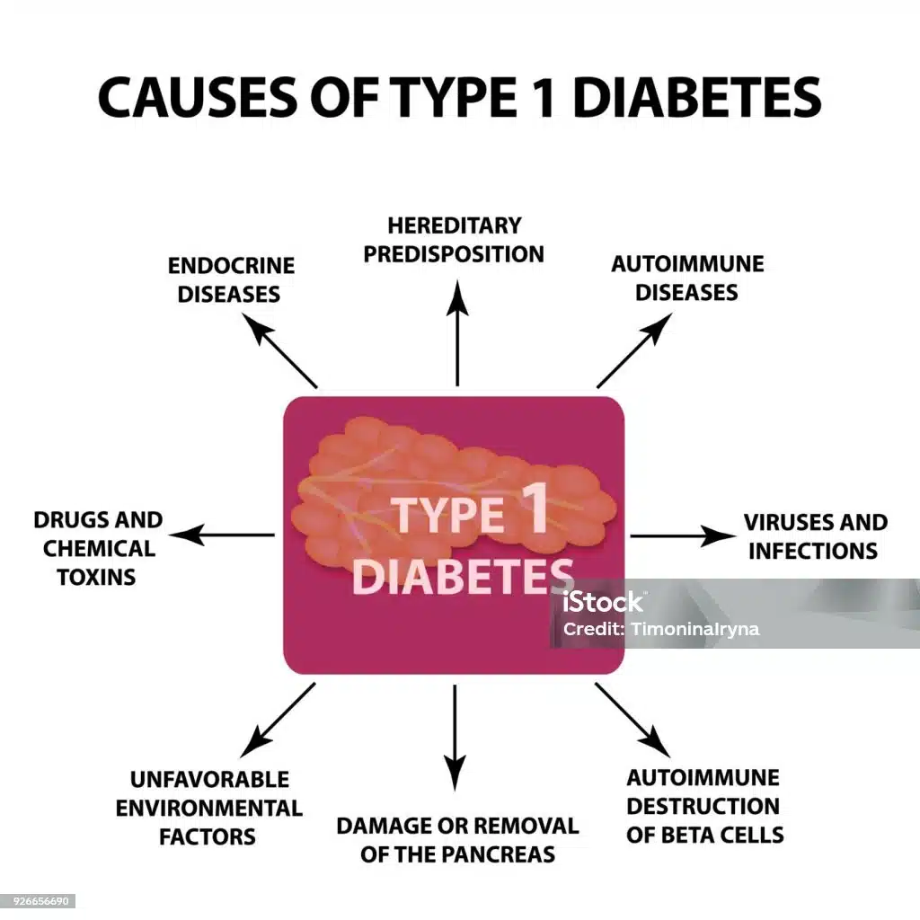 Penyebab Diabetes Tipe 1 1 Penyebab Diabetes Tipe 1