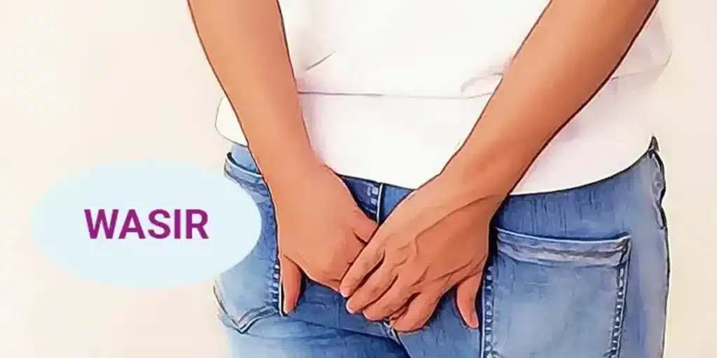 Penyebab Wasir yang Umum 1 Penyebab Wasir yang Umum