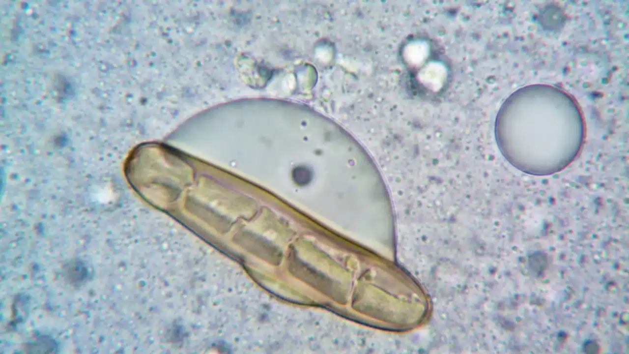 Bacteria Virus Pollen Allergy