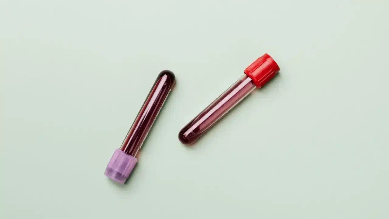 Blood Color Chart Red Blood