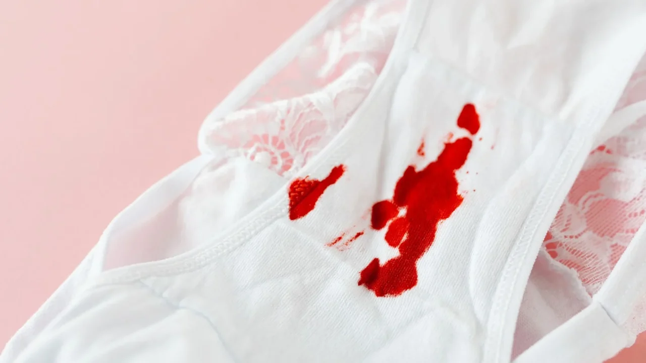Perbedaan Abses Perianal dan Hemoroid: Panduan Lengkap 3 Blood Stain Itchy Skin