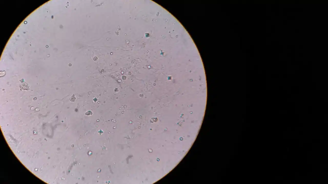 Jenis Kanker Payudara: Kenali & Pahami Perbedaannya 2 Breast Cells Microscope