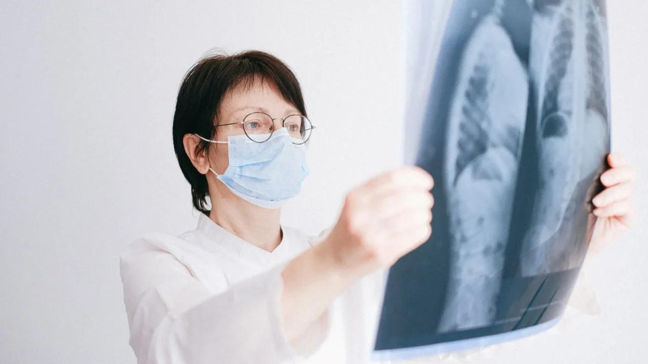 Perbedaan TBC dan Kanker Paru-Paru: Panduan Lengkap 2 Cancer Cell Lung Scan