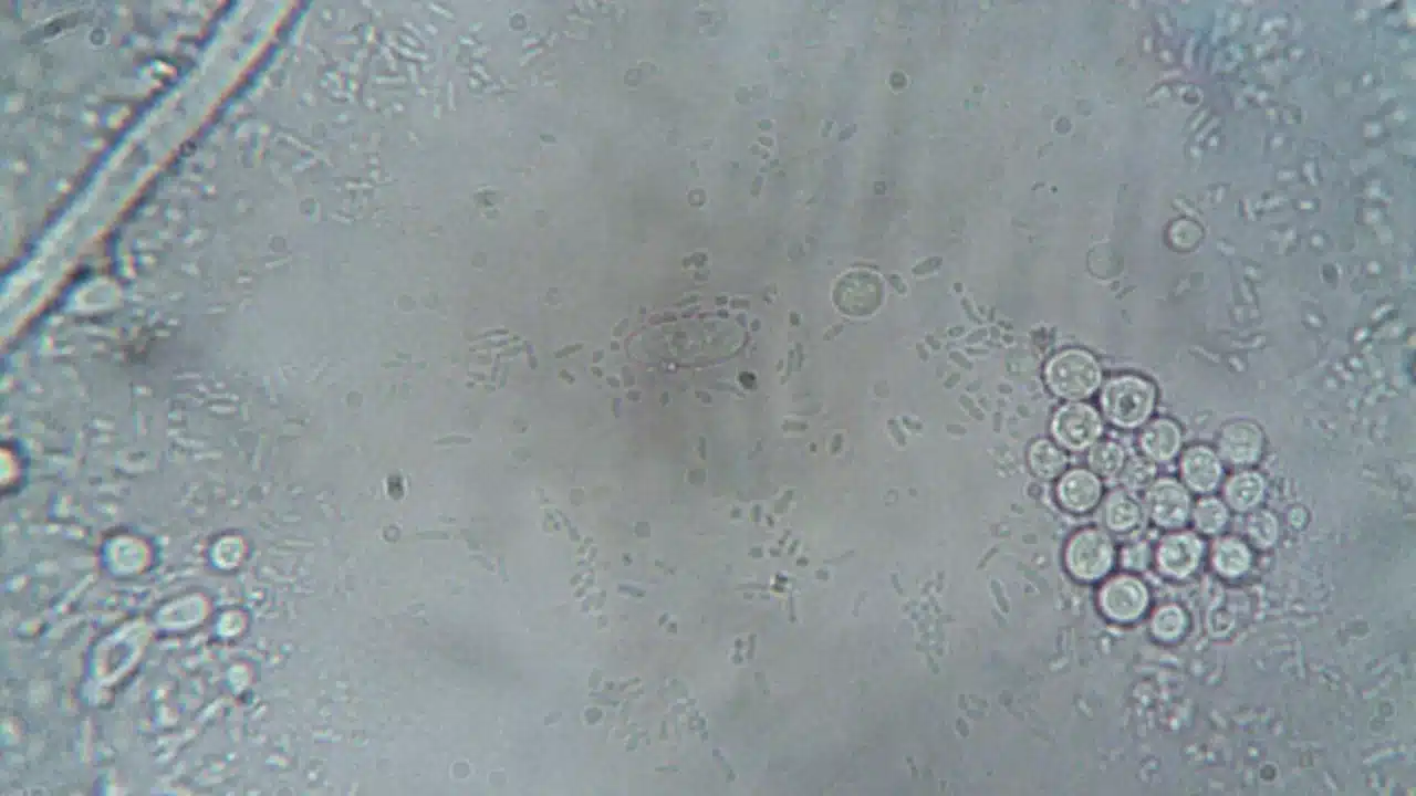 Apa Itu Kolesterol? Panduan Lengkap Kesehatan Jantung 3 Cell Structure Hormone Production