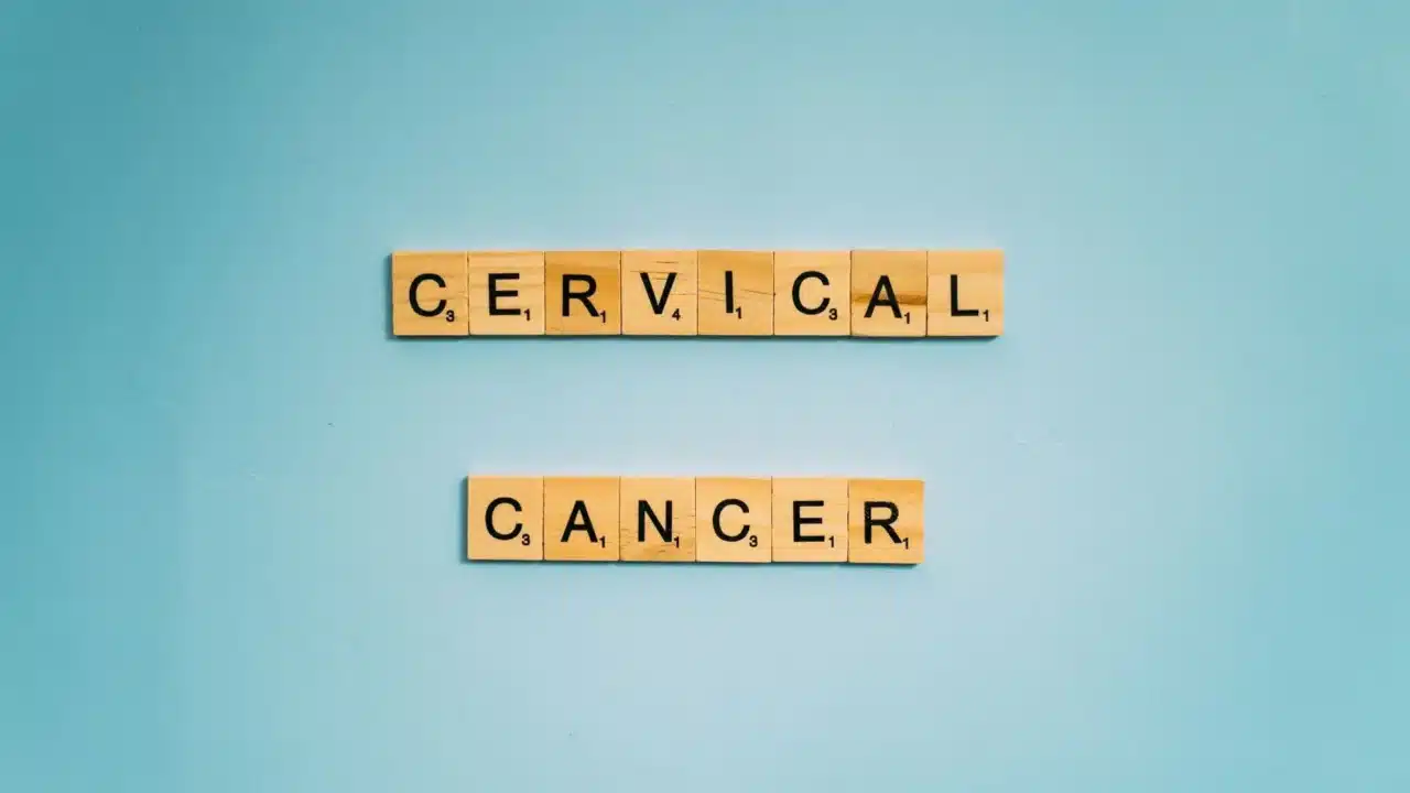 Cervix Anatomy Cancer Cells
