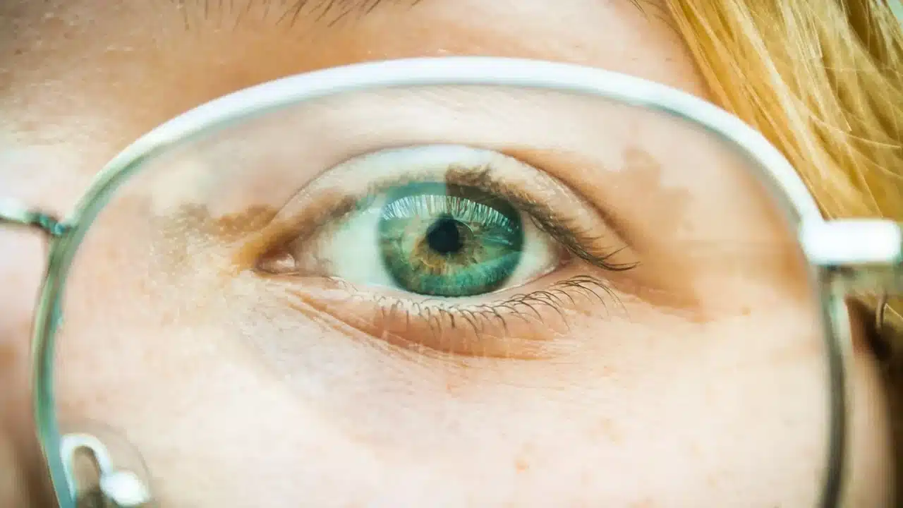 Eye Diagram Astigmatism Blurry Vision