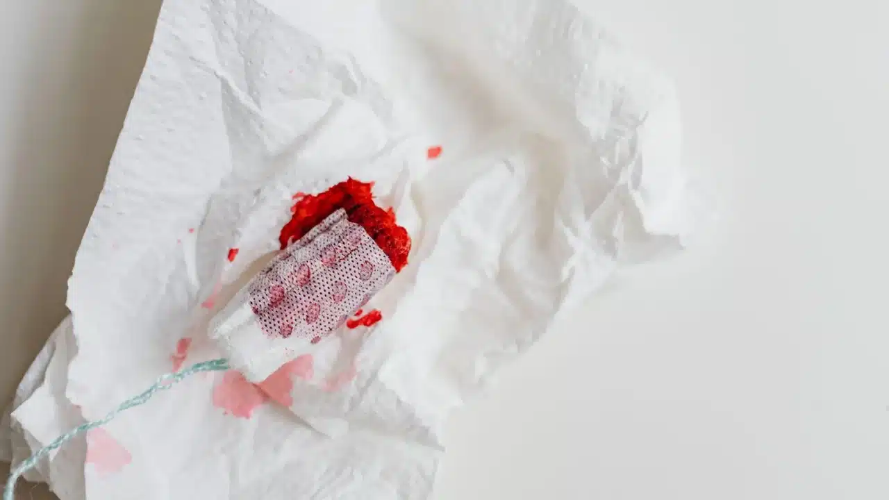 Ambeien Berdarah: Penyebab, Gejala, dan Solusi Tuntas 1 Hemorrhoid Bleeding Intestine