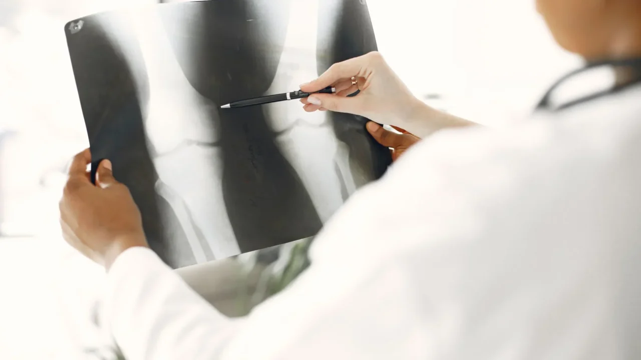 Penyebaran Kanker Paru-paru: Gejala, Tahapan, dan Pencegahan 3 Human Brain Human Bones Human Liver