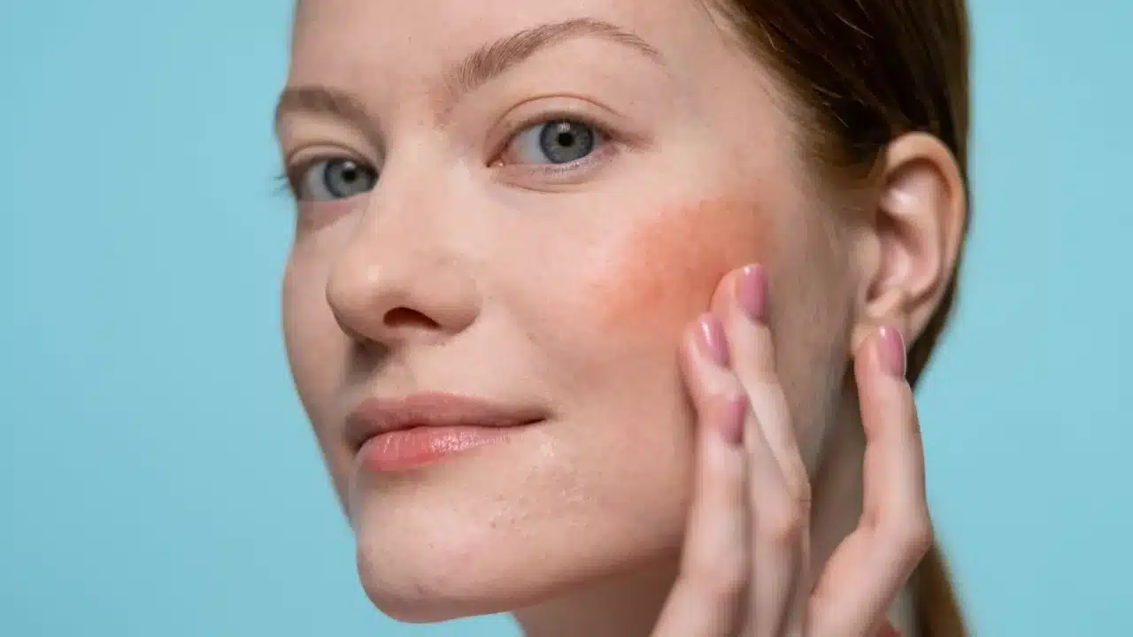 Resiko Suntik Silikon Jangka Panjang & Bahayanya 3 Inflammation Redness