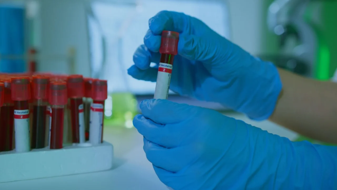 Lab Test Medical Sample