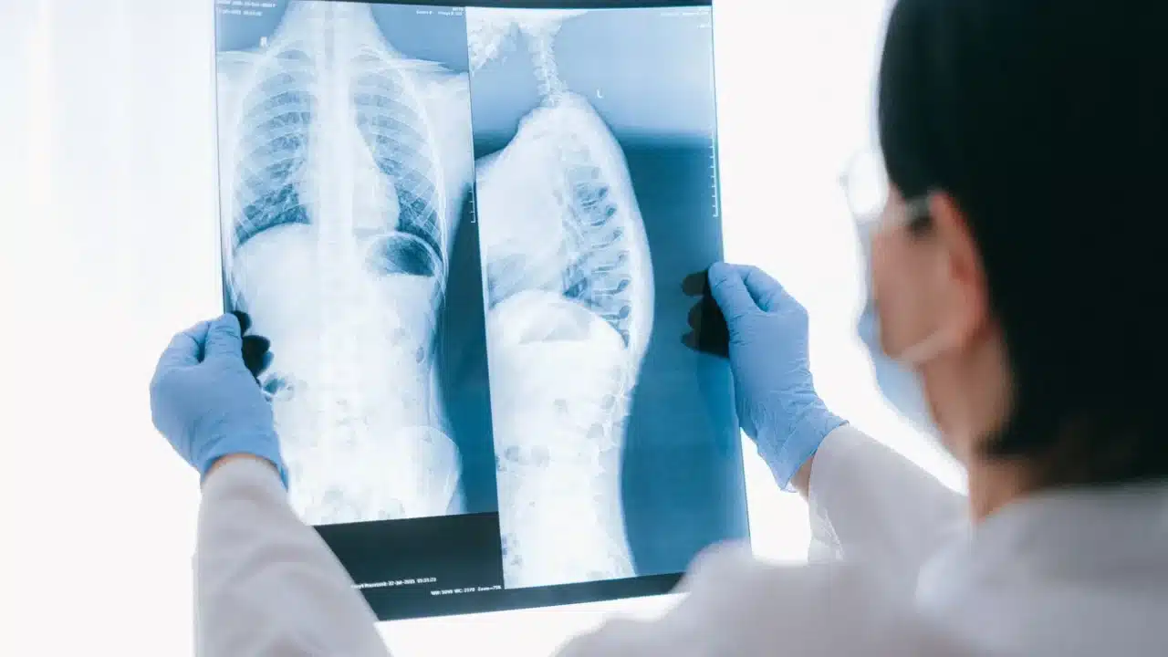 Lungs Healthy Lungs