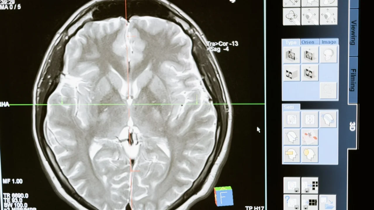 Medical Diagram Tnm Staging