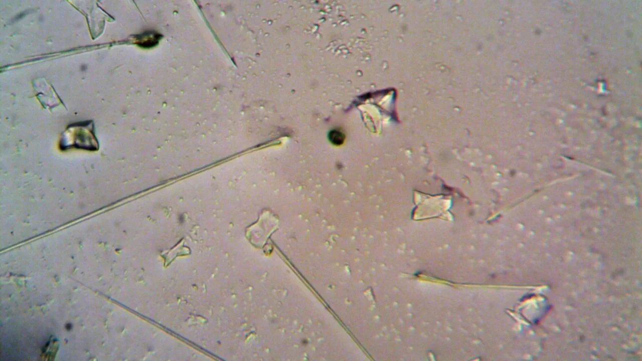 Prostate Gland Healthy Cell