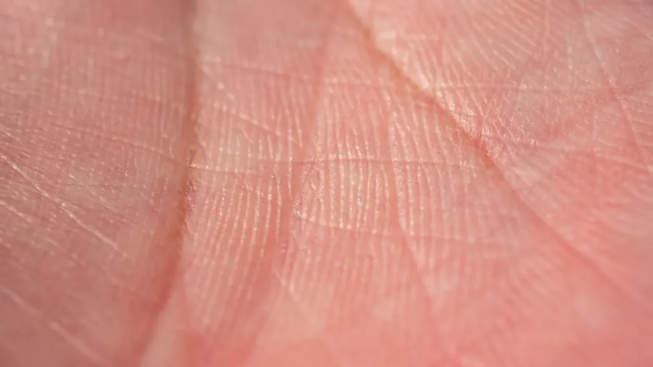 Skin Mole Human Skin