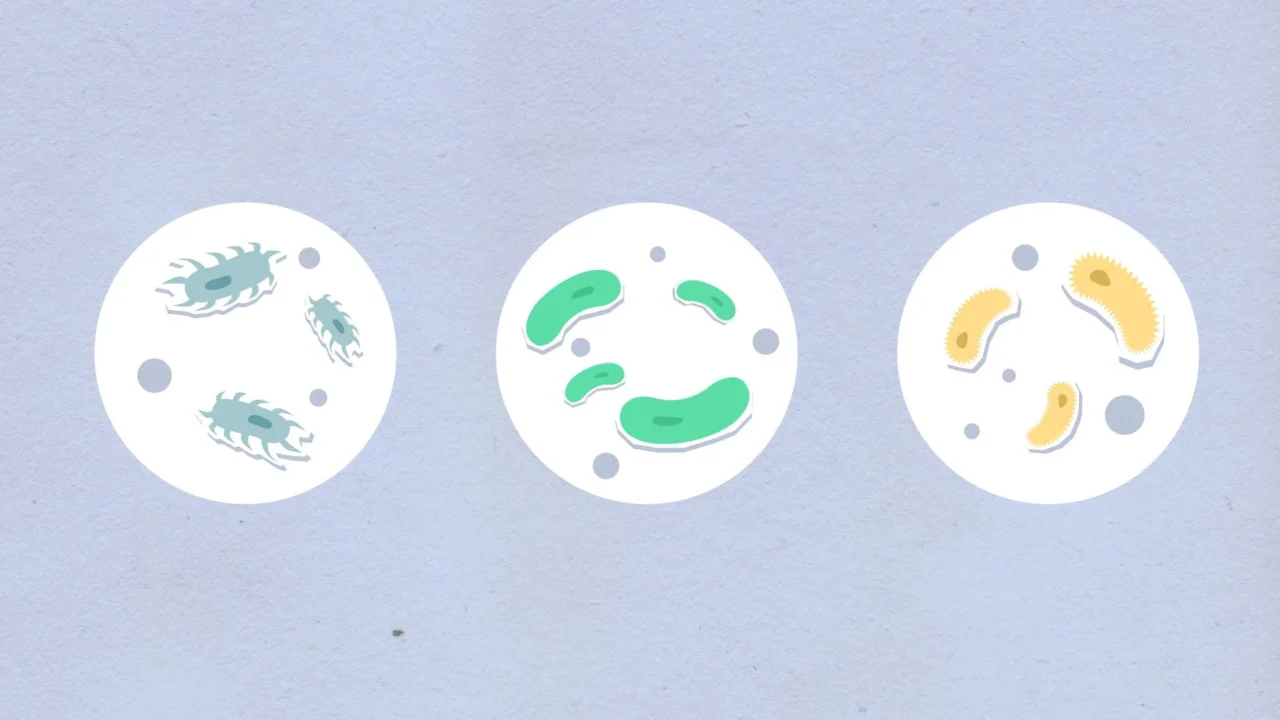 Perbedaan Sipilis dan Raja Singa: Fakta & Penjelasan Lengkap 1 Syphilis Bacteria Microscope Medical Symbol