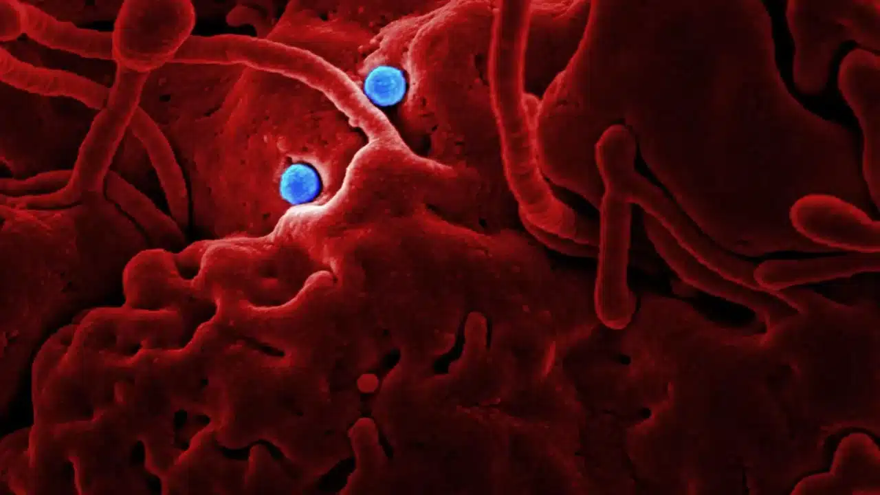 Risiko Penularan Herpes Genital: Pencegahan & Penanganan 1 Virus Microscope Health