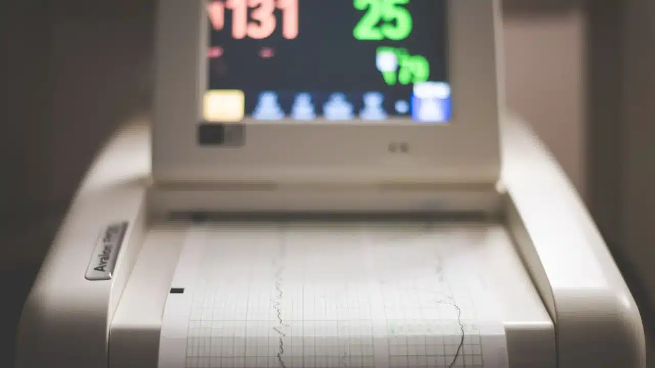 Tahapan Kanker Kelenjar Getah Bening: Panduan Lengkap 2 Ann Arbor System Medical Chart