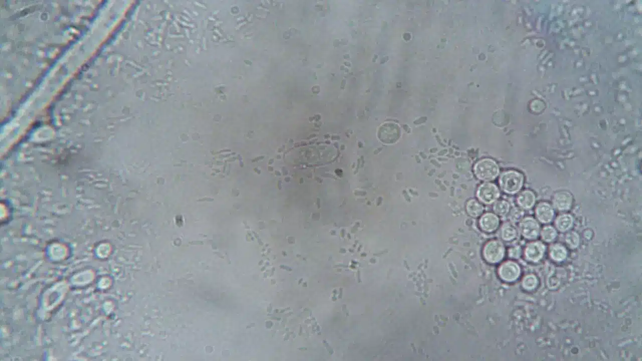 Bacteria Microscope Medical Diagram