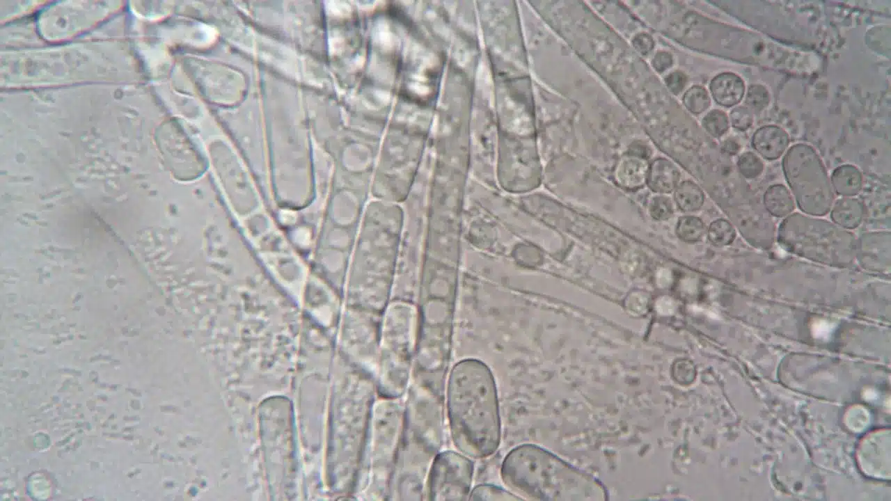 Bahaya Sifilis: Gejala, Komplikasi, dan Pencegahan Efektif 1 Bacteria Microscope Sexual Health
