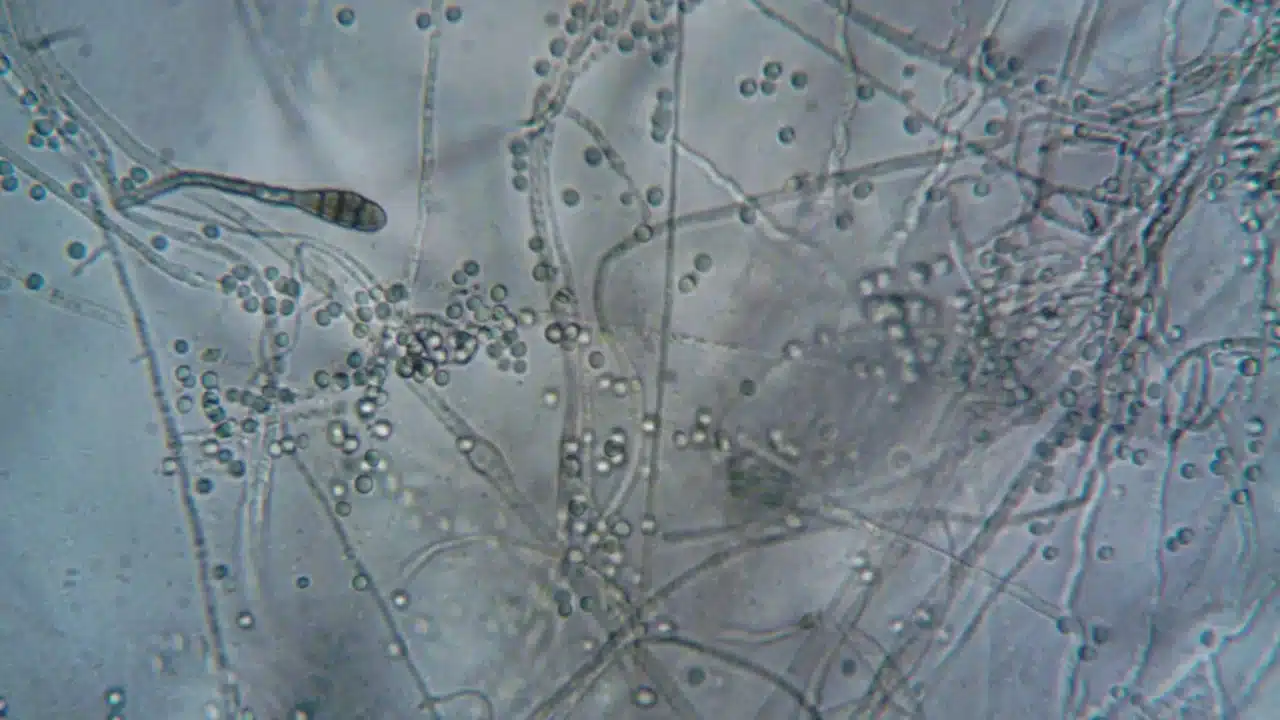 Bacteria Typhoid Fever