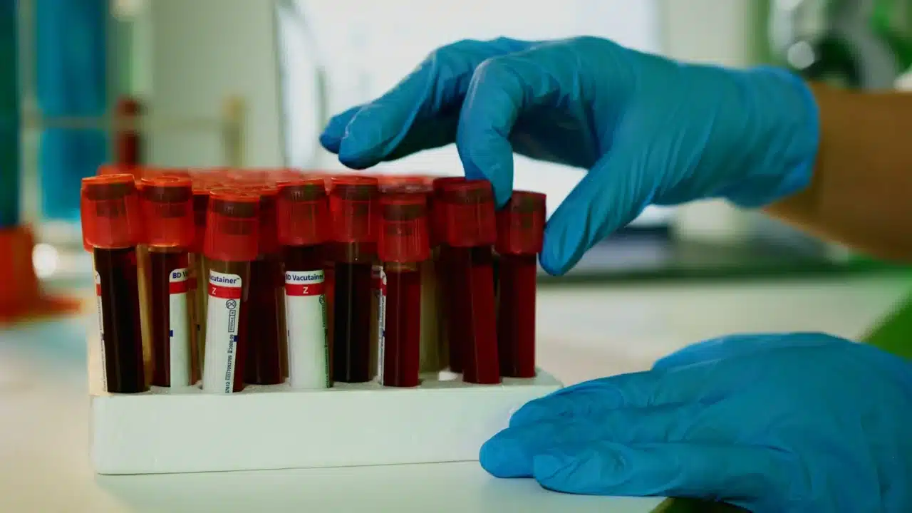 Blood Test Laboratory Medical Checkup