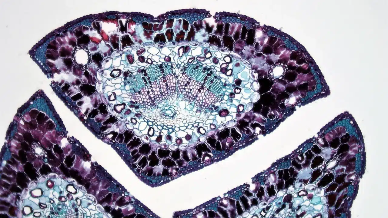 Jenis Kanker Usus Besar: Gejala, Penyebab & Pencegahan 2 Cancer Cells Microscope Colon Tissue
