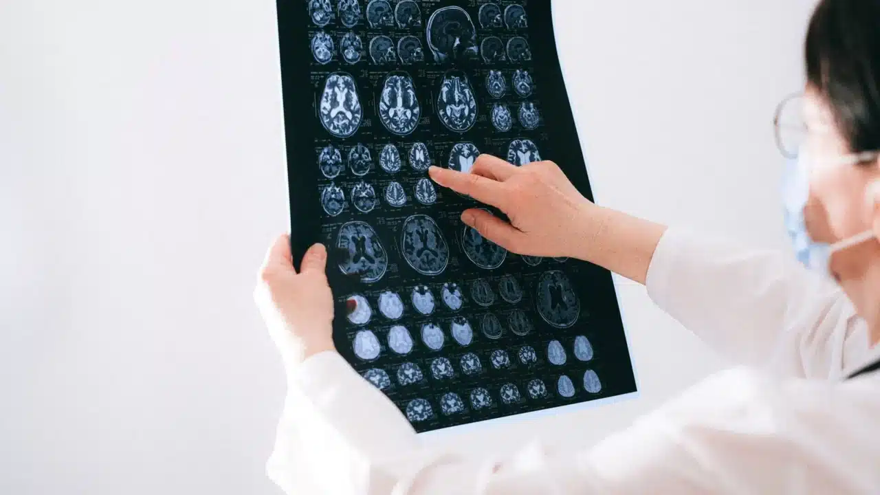 Bahaya Sifilis: Gejala, Komplikasi, dan Pencegahan Efektif 3 Damaged Organ Heart Disease Brain Scan