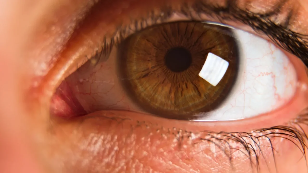 Terapi Mata Silinder: Pilihan, Prosedur, & Pemulihan 1 Eye Anatomy Blurred Vision