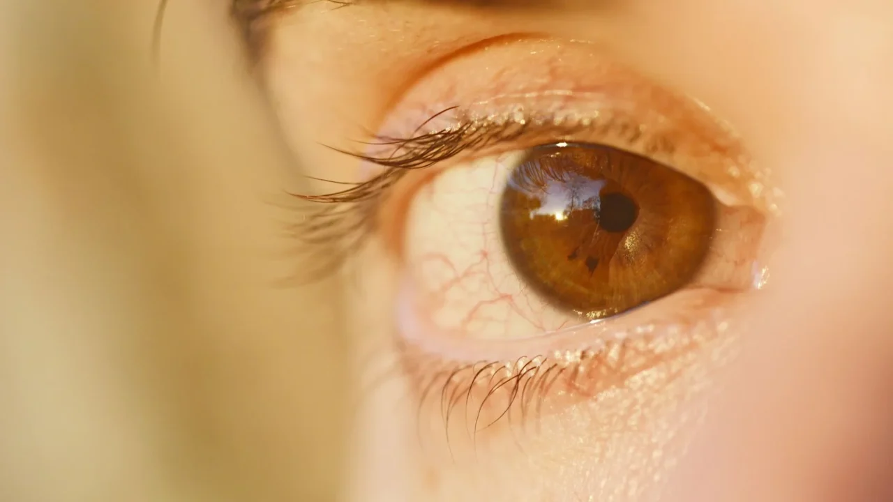 Cara Mencegah Glaukoma: Panduan Lengkap Kesehatan Mata 1 Eye Anatomy Optic Nerve Eye Pressure
