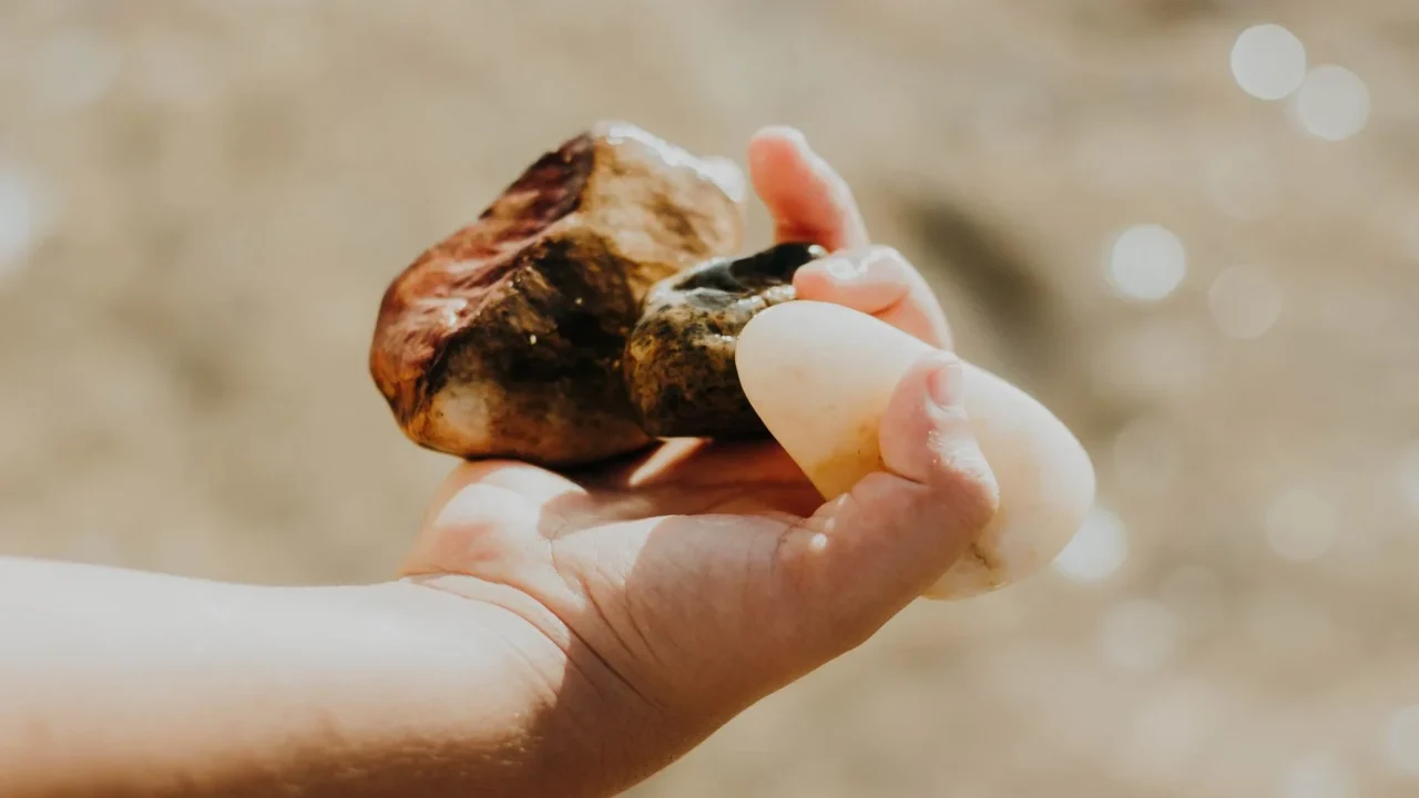 Perbedaan Batu Ginjal dan Batu Empedu: Gejala & Pengobatan 2 Gallbladder Stone Human Gallbladder