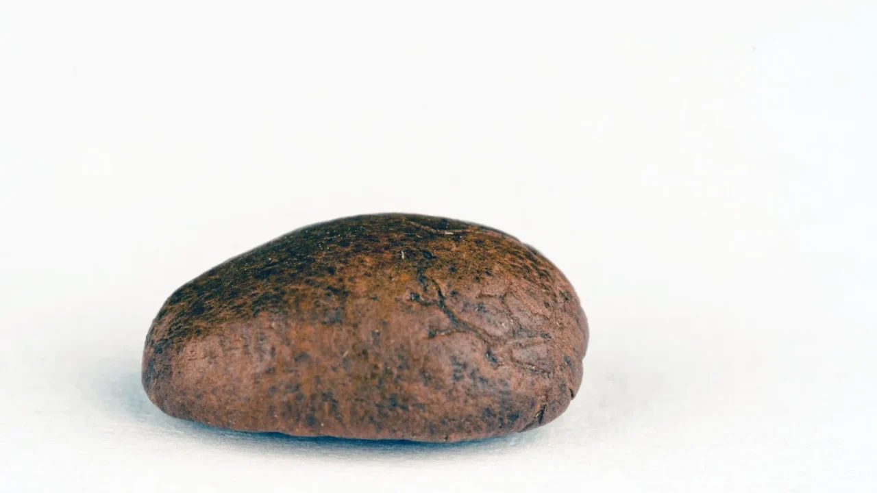 Makanan untuk Penderita Batu Ginjal: Panduan Lengkap 1 Kidney Stone Human Kidney