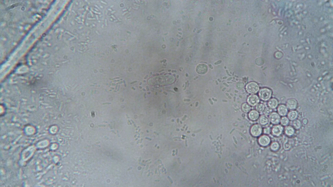 Apakah TBC Berbahaya? Pahami Risiko dan Pencegahannya 1 Lung Bacteria