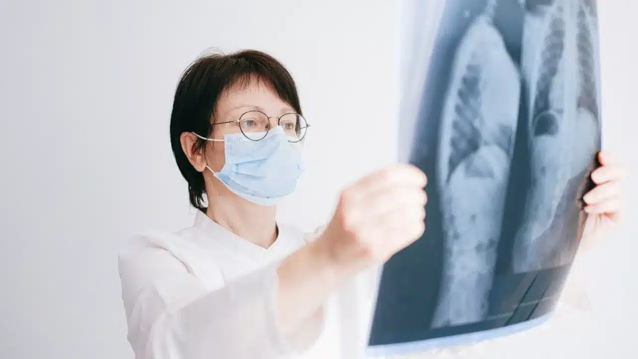 Lung Cancer Stage 1 Medical Diagram