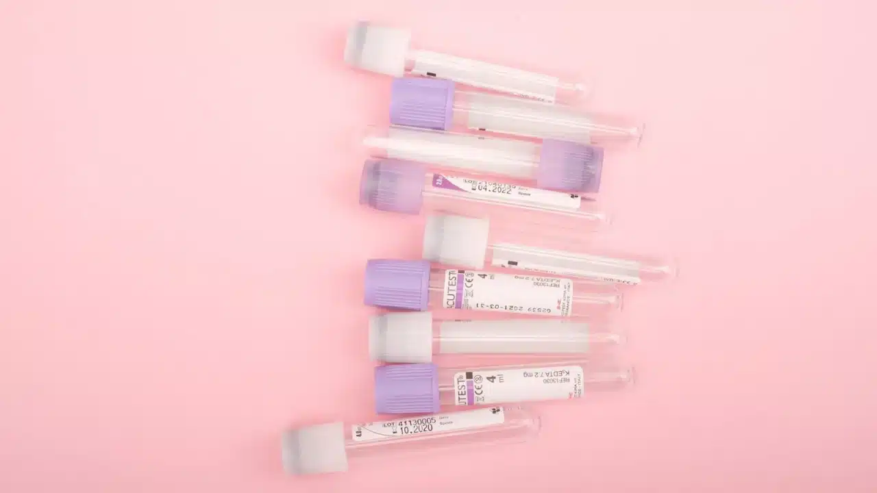 Jenis-jenis Kanker Ovarium: Klasifikasi & Gejala 4 Risk Factors Genetic Testing
