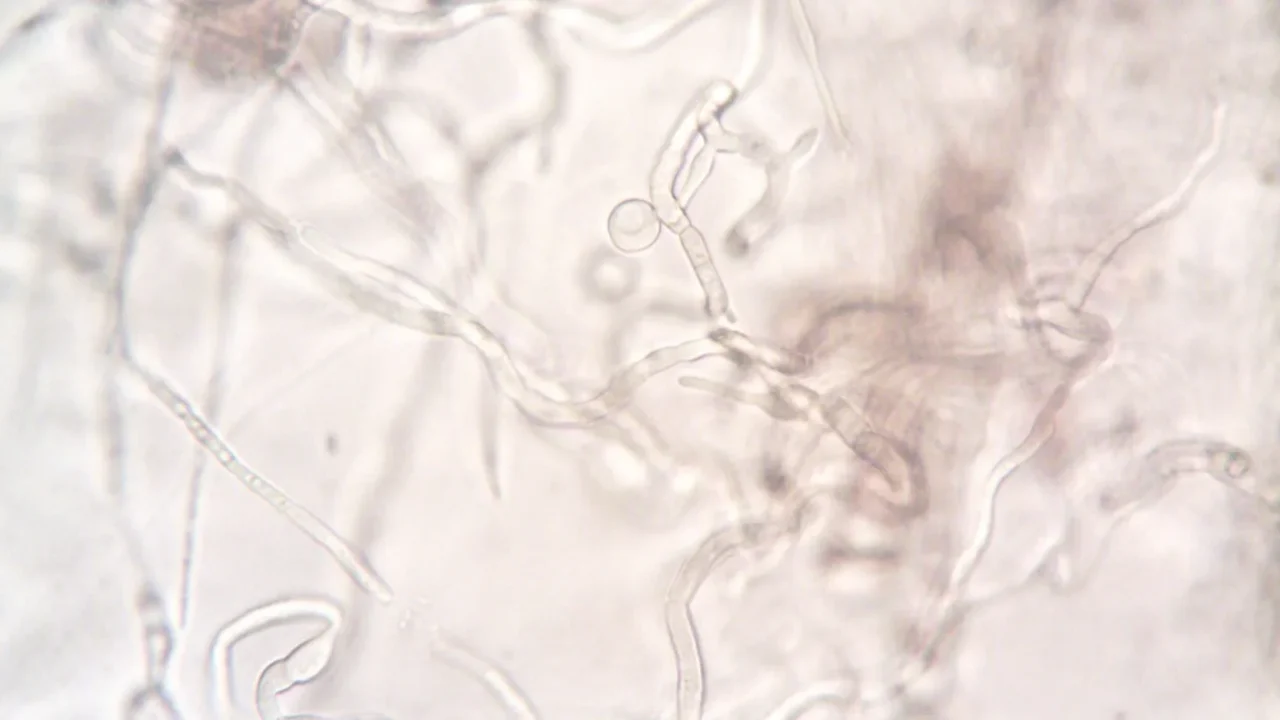 Makanan Penyebab Panu: Pemicu & Pencegahan Jamur Kulit 1 Skin Fungus Microscope View