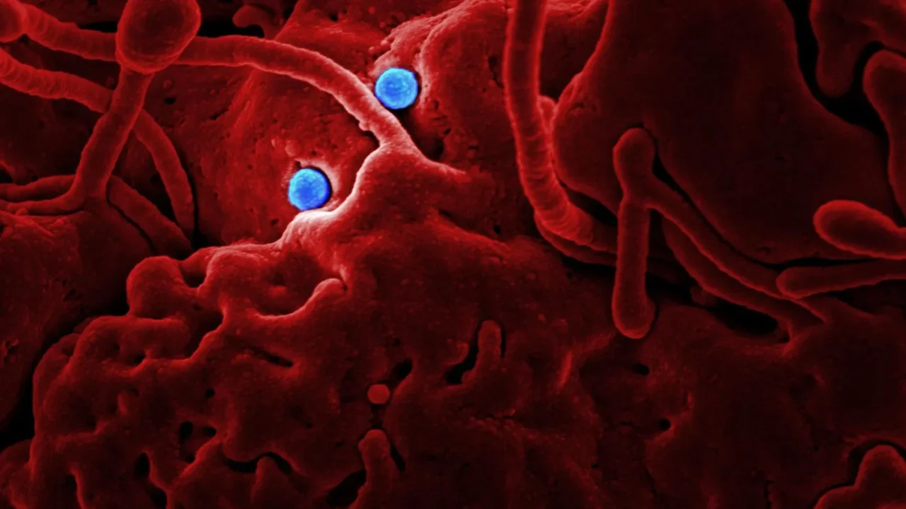 Gejala HIV Tahap Awal: Kenali & Pahami untuk Deteksi Dini 1 Virus Cell Infection