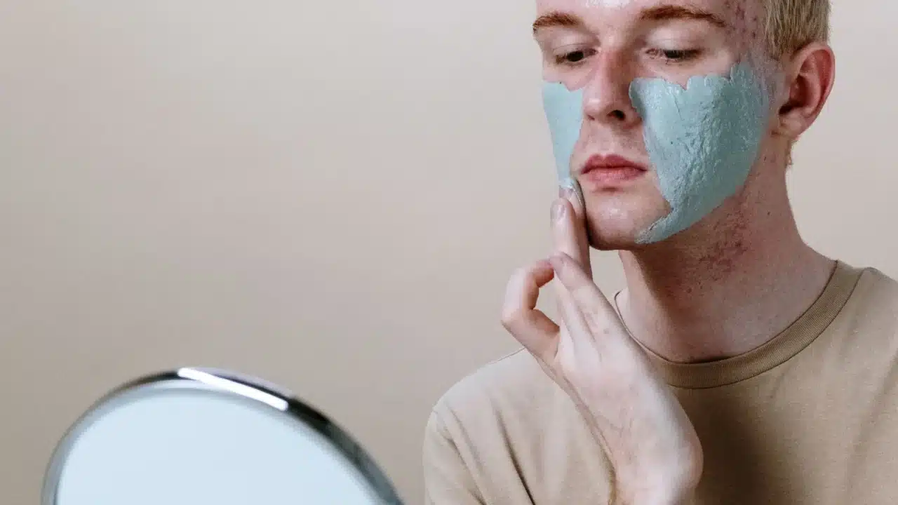Cara Merawat Kulit Berjerawat secara Efektif dan Aman 1 acne skin facial pores