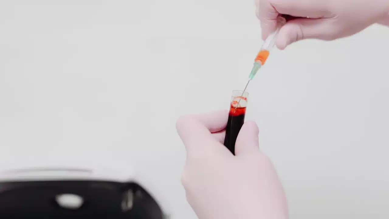Panduan Lengkap Diabetes Melitus: Gejala & Obatin 1 blood test doctor
