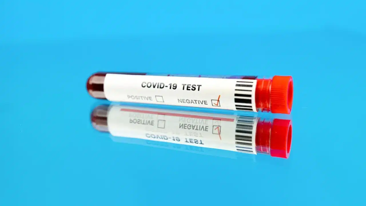 blood test laboratory sample