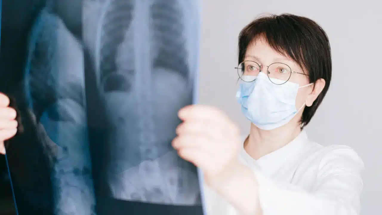 Asam Lambung vs GERD: Perbedaan, Gejala, dan Penanganan 2 human chest medical chart