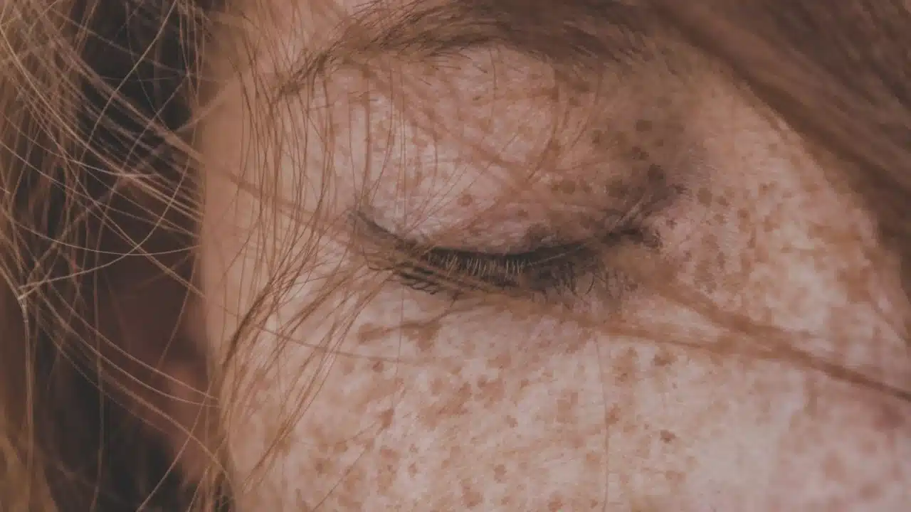 Ciri-ciri Penyakit Kuning yang Wajib Diwaspadai 2 human eye skin