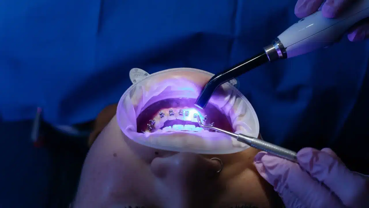 Cara Mengobati Psoriasis: Panduan Medis dan Alami 4 light therapy uv lamp