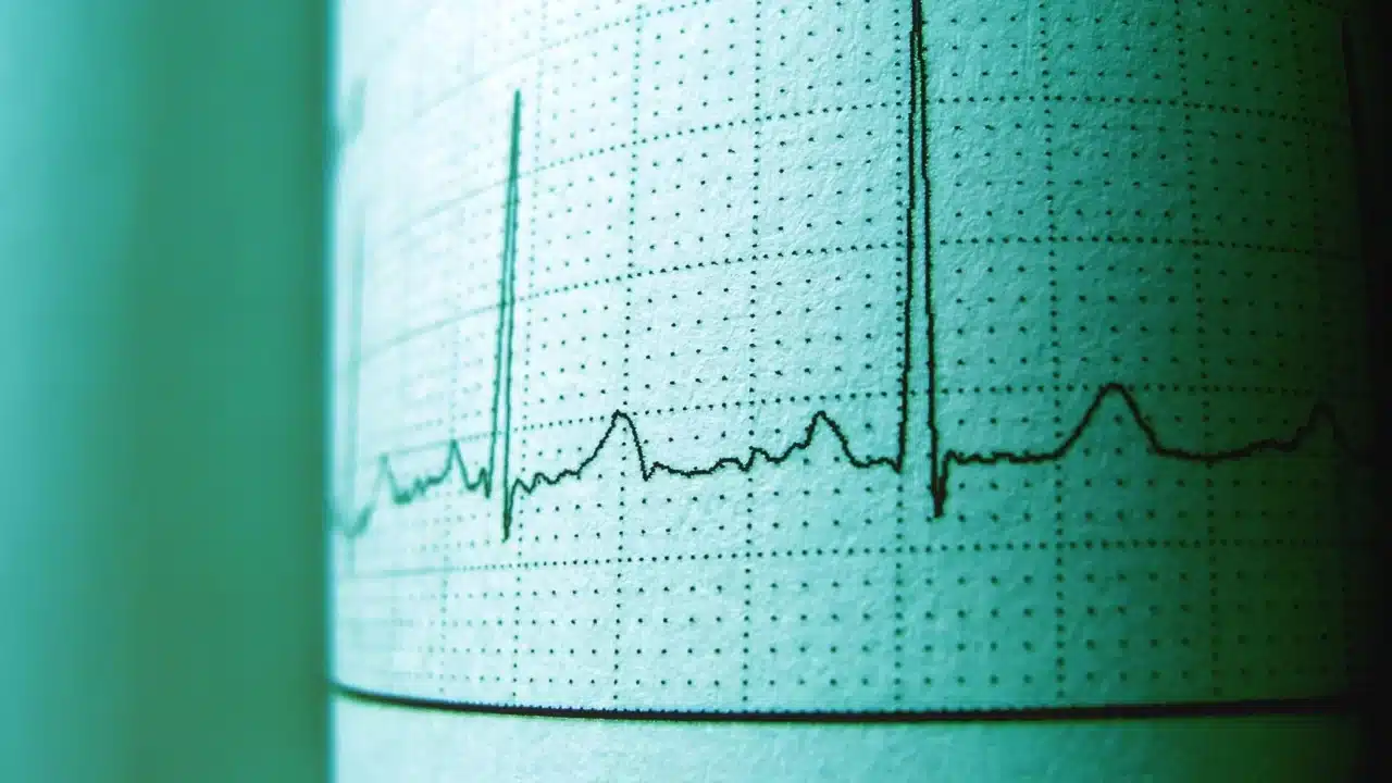 Miom Apakah Berbahaya? Kenali Gejala & Penanganan 3 Medical Danger Risk Assessment